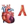 Infarctus du myocarde