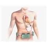 Ventricule artificiel intracorporel