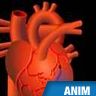 Attaque cardiaque, infarctus du myocarde Attaque cardiaque, infarctus du myocarde